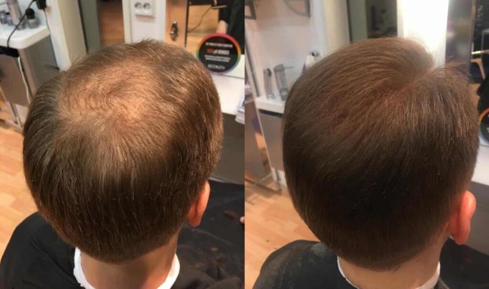 Parykk oslo  veien til naturlig hår og trygghet i hverdagen